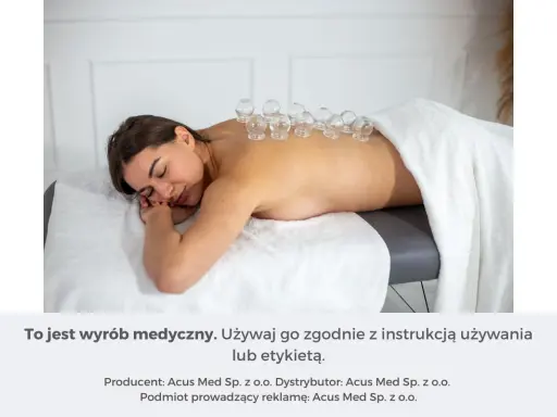 Kobieta leży na plecach, na jej kręgosłupie umieszczono szklane bańki na plecy.