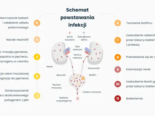 Schemat powstawania infekcji, prowadzącej do nawracającego zapalenia pęcherza. Ukazuje drogę bakterii od jelit do nerek.