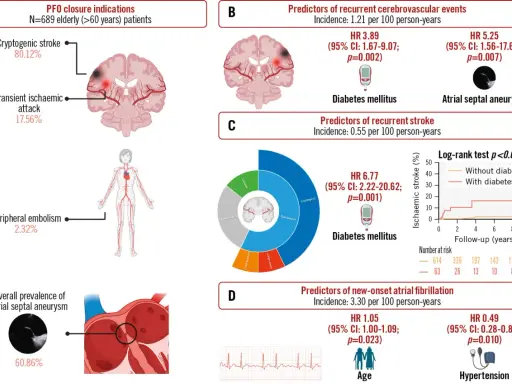 PFO closure indications: 80% kryptogenny udar, 17% TIA. Obraz przedstawia objawy neurologiczne i czynniki ryzyka udaru.