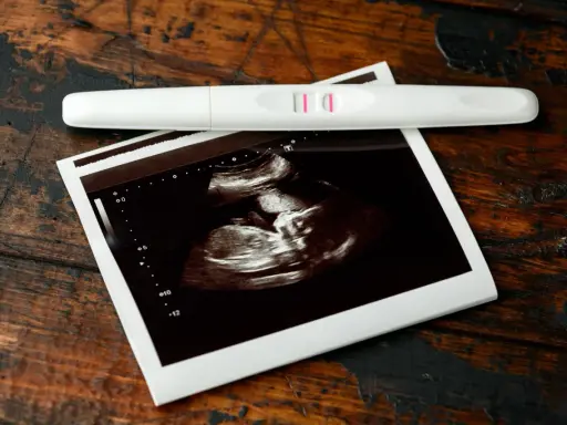 USG 7 tydzień ciąży pokazuje zarodek. Obok leży pozytywny test ciążowy.