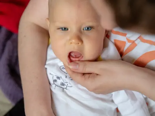 Widok na buzię niemowlaka, któremu rodzic delikatnie podnosi wargę, ukazując, jak wygląda przebijający się zabek.