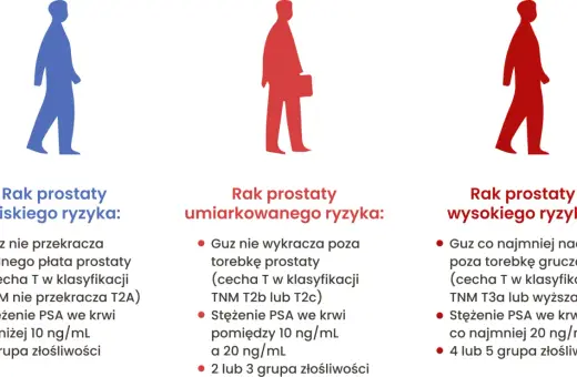Ilustracja pokazuje trzy sylwetki mężczyzn, symbolizujące różne stadia raka prostaty: niskiego, umiarkowanego i wysokiego ryzyka. Opisuje, jak wygląda badanie prostaty w zależności od stopnia zaawansowania.