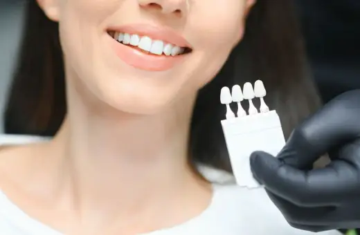 Uśmiechnięta kobieta z białymi zębami, dentysta porównuje odcień zębów z wzornikiem przed wybielaniem.