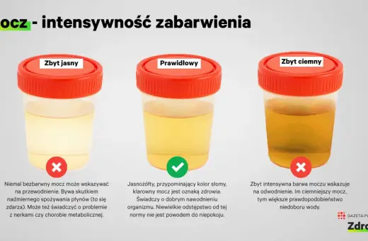Jasny, prawidłowy i ciemny mocz. Intensywnie pomarańczowy mocz po nocy może świadczyć o odwodnieniu.