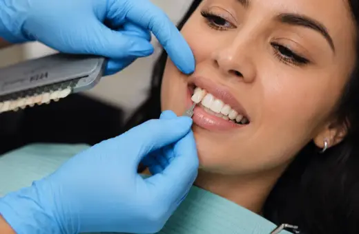 Dobór idealnego odcienia licówek kompozytowych. Dentysta porównuje kolor zębów pacjentki z wzornikiem.