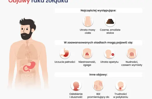 Ilustracja przedstawia objawy raka żołądka: utratę masy ciała, czarne stolce, uczucie pełności, niestrawność, zgagę, utratę apetytu, nudności, wymioty, osłabienie, ból pleców i trudności w połykaniu.