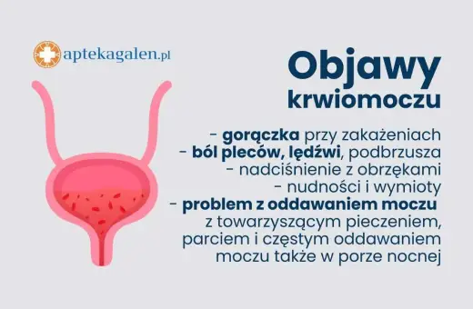 Objawy krwiomoczu: gorączka, ból pleców, nudności. Furaginum może pomóc w leczeniu infekcji dróg moczowych.