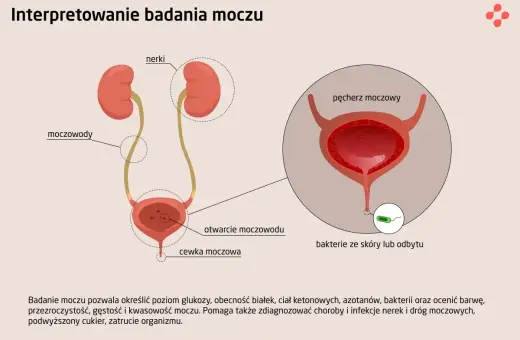 Schemat układu moczowego z nerkami, moczowodami, pęcherzem i cewką. Ilustracja pokazuje różne rodzaje moczu i bakterie.