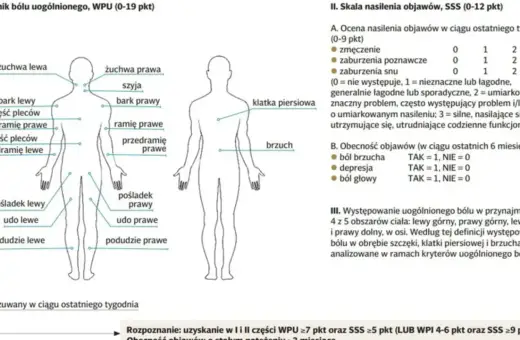 Schemat przedstawia lokalizację bólu w fibromialgii. Co to jest fibromialgia? To zespół objawów, m.in. bólu, zmęczenia, zaburzeń snu.