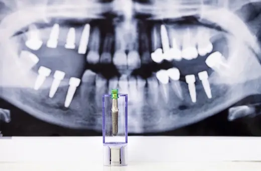 Zęby na zdjęciu RTG i implant w etui. Może to symbolizować odrzucenie implantu zęba lub jego przygotowanie.