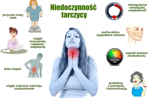 Objawy niedoczynności tarczycy: przyrost masy ciała, zmęczenie, bóle mięśni, wahania nastroju, sucha skóra, wypadanie włosów, problemy z pamięcią. Jakie badania na tarczycę wykonać?
