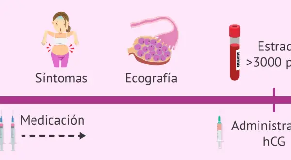 Proceso de donación de óvulos: síntomas, ecografía, medicación, estradiol alto y administración de hCG. A veces, duele donar óvulos.