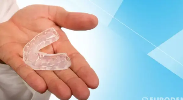 Mano che tiene un bite trasparente. Questo dispositivo, se usato correttamente, può aiutare a correggere la posizione dei denti.