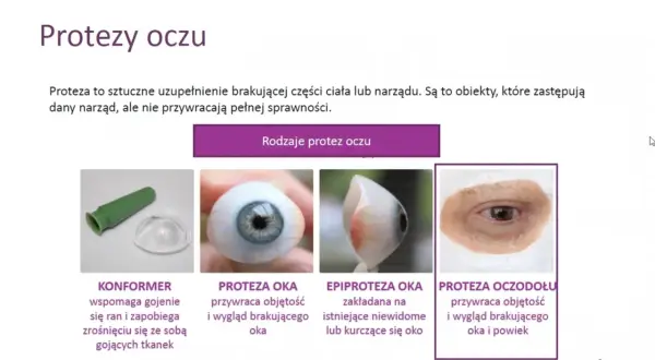 Różne rodzaje protez oczu: konformer, proteza oka, epiproteza oka, proteza oczodołu.
