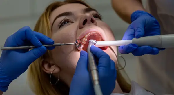 Dentysta pomaga zabezpieczyć ząb po wypadnięciu plomby, używając narzędzi stomatologicznych.