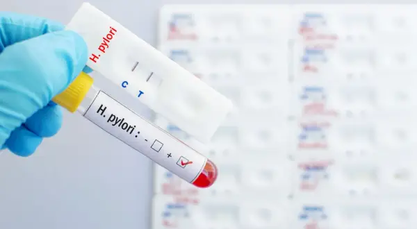 Ręka w niebieskiej rękawiczce trzyma probówkę z oznaczeniem "H. pylori: +" i test kasetkowy z dwoma paskami, wskazującymi pozytywny wynik helicobacter pylori badanie.