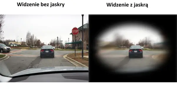 Widzenie bez jaskry jest ostre, z jaskrą widzenie w nocy jest rozmazane, jakby przez mgłę.
