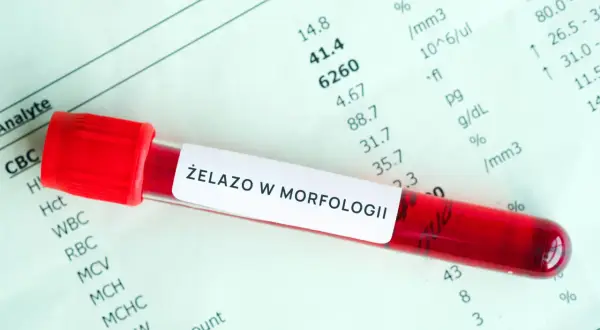 Probówka z krwią i wynikami badań. Etykieta "ŻELAZO W MORFOLOGII" sugeruje analizę poziomu żelaza, kluczowego dla utrzymania żelazo norma.
