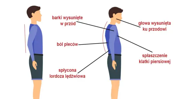 Ilustracja porównująca prawidłową i nieprawidłową postawę ciała, z zaznaczonym bólem pleców.