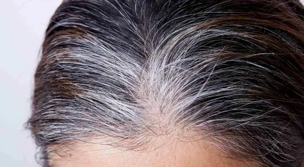 Gros plan sur des cheveux mi-bruns, mi-blancs. Un temps de pause coloration cheveux blancs est peut-être en cours, laissant apparaître des mèches argentées naturelles.
