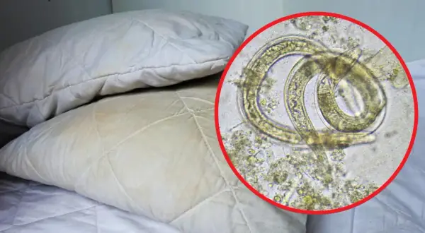 Kiedy zmienić pościel po odrobaczaniu, aby uniknąć reinfekcji?