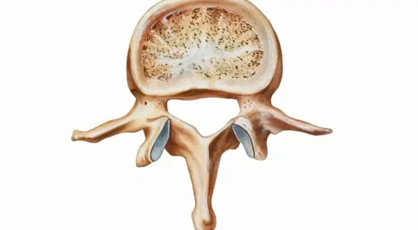 Przekrój kręgu z widoczną gąbczastą strukturą kości, która może być oznaką osteopenii.
