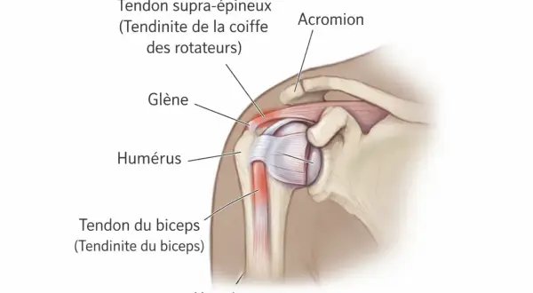 Anatomie de l'épaule montrant le tendon supra-épineux et le tendon du biceps, zones souvent affectées par une tendinite. Cet **exercice tendinite épaule** vise à soulager ces douleurs.