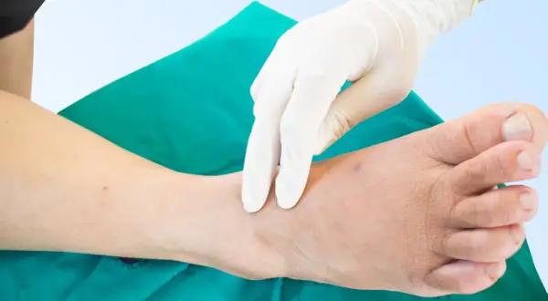 Mano guantata esegue un massaggio per la fisioterapia per neuropatia arti inferiori, concentrandosi sulla caviglia e sul piede.