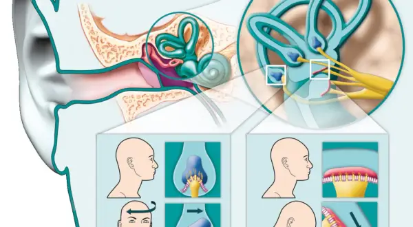 Illustrazione dell'orecchio interno e dei canali semicircolari, con diagrammi che mostrano movimenti della testa per alleviare le vertigini. Rimedi della nonna per cervicale e vertigini.