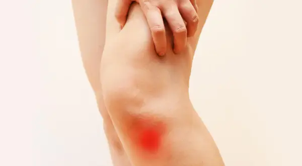 Mano che si stringe sul ginocchio con un'area rossa che indica fitte al ginocchio.