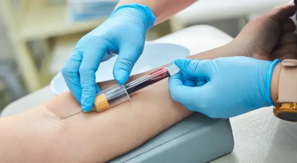 Pobieranie krwi do badań, które pomogą ocenić, jak szybko obniżyć próby wątrobowe.