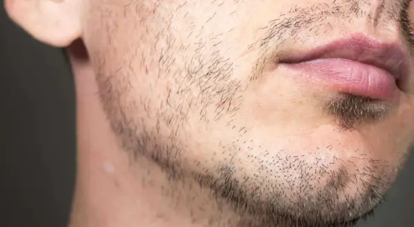 Un homme de 25 ans avec une barbe clairsemée et des lèvres roses. Il a une petite cicatrice sur la joue.