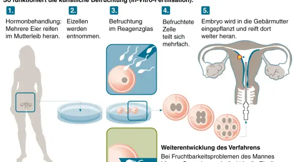 Schema erklärt die IVF-Bedeutung: Hormonbehandlung, Eizellentnahme, Befruchtung im Reagenzglas, Zellteilung, Embryotransfer in die Gebärmutter.