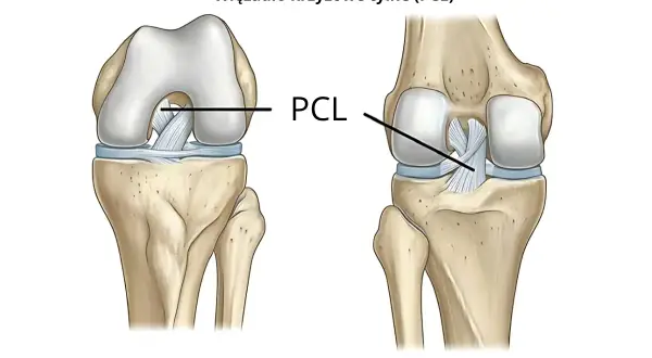Anatomia stawu kolanowego: widok z przodu i z tyłu, ukazujący kości kończyny dolnej i więzadło krzyżowe tylne (PCL).