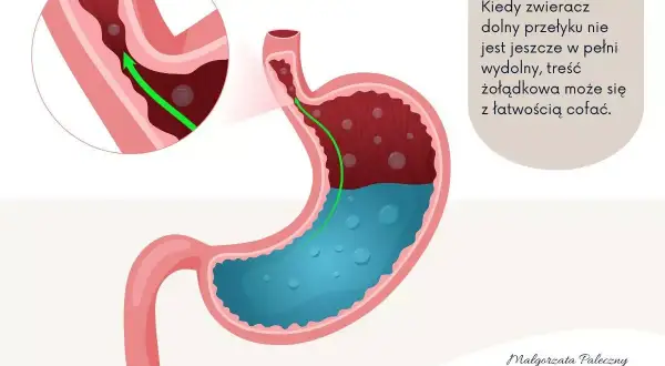 Ilustracja pokazuje żołądek z cofającą się treścią, co jest przyczyną refluksu u niemowlaka. Zielona strzałka wskazuje cofanie się pokarmu.