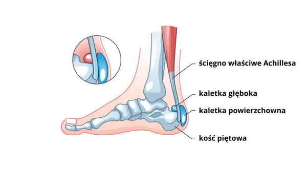 Anatomia pięty: ścięgno Achillesa, kaletki i kość piętowa.