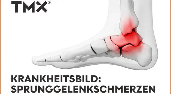 Anatomische Darstellung eines Fußes mit rot hervorgehobenen Bereichen, die Sprunggelenkschmerzen anzeigen. TMX-Logo oben.