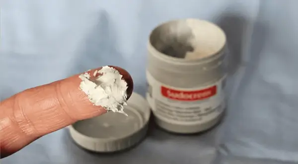 Czy Sudocrem jest dobry na pryszcze? Sprawdź jego skuteczność i ryzyko