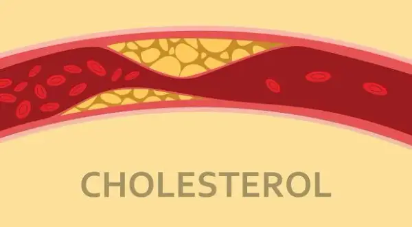 Czym jest cholesterol? Rola, rodzaje i skutki dla zdrowia – wszystko, co musisz wiedzieć