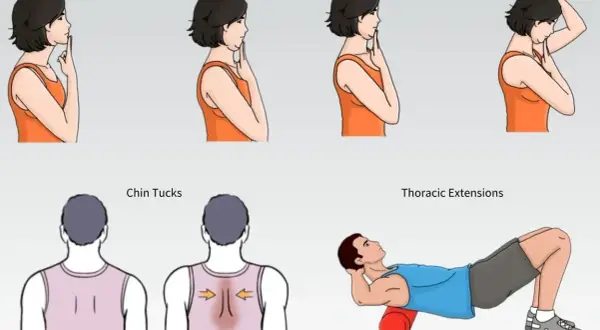 Esercizi per correggere la sindrome della testa in avanti: chin tucks, flessione del collo e estensioni toraciche con rullo.