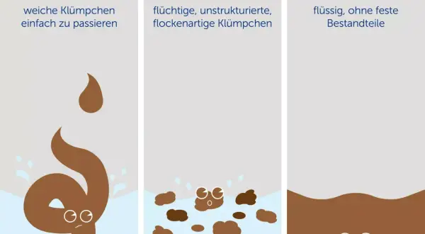 Durchfall: Typ 7 zeigt flüssigen, hellbraunen Stuhl wie Wasser, ohne feste Bestandteile.