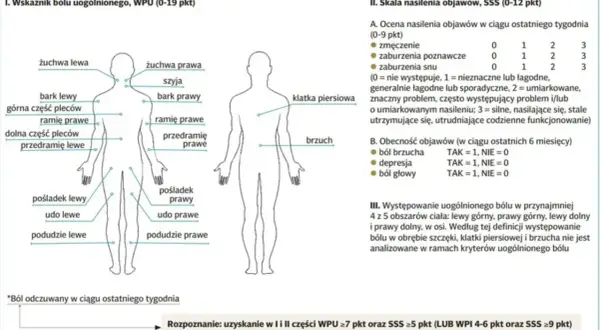 Schemat przedstawia lokalizację bólu w fibromialgii. Wskazuje obszary ciała, gdzie może występować ból, pomagając zrozumieć, co to jest fibromialgia.