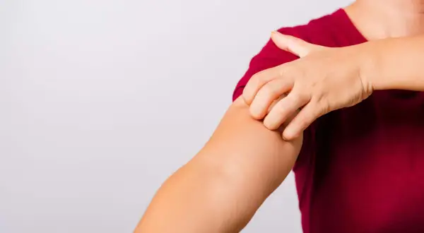 Eine Hand kratzt sich am Arm. Vielleicht hilft **Essig gegen Juckreiz**?