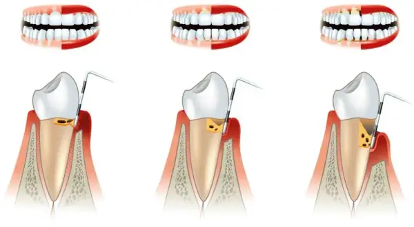 Periodontolog: Kiedy iść z dziąsłami? Przewodnik po specjalistach