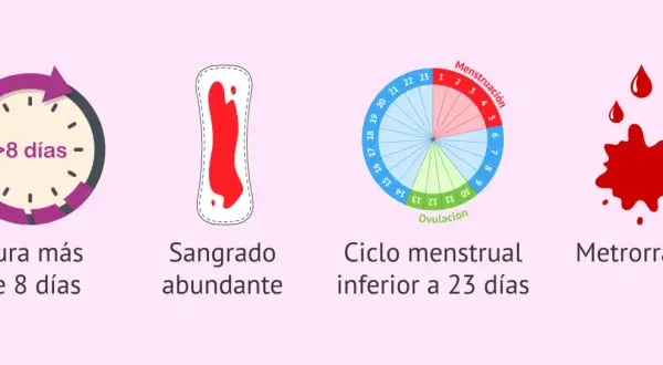 Señales para saber si me va a bajar la regla: duración >8 días, sangrado abundante, ciclo <23 días o metrorragia.