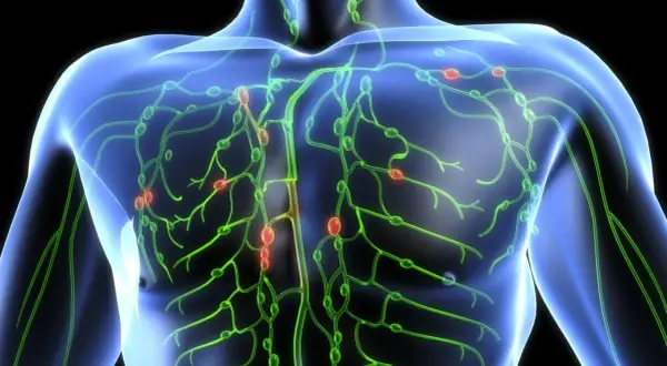 Das Lymphsystem des menschlichen Oberkörpers mit hervorgehobenen Lymphknoten. Dies kann helfen zu verstehen, was ein Lymphom ist.
