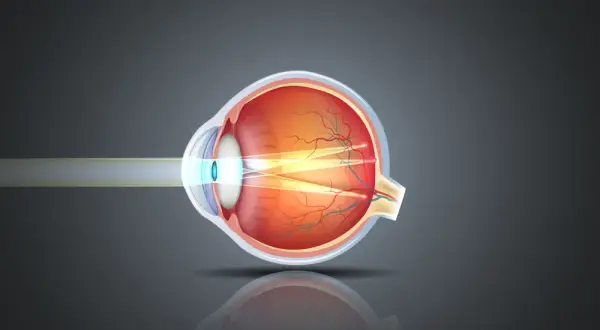 Astygmatyzm: Okulista czy Optometrysta? Sprawdź, kogo wybrać!