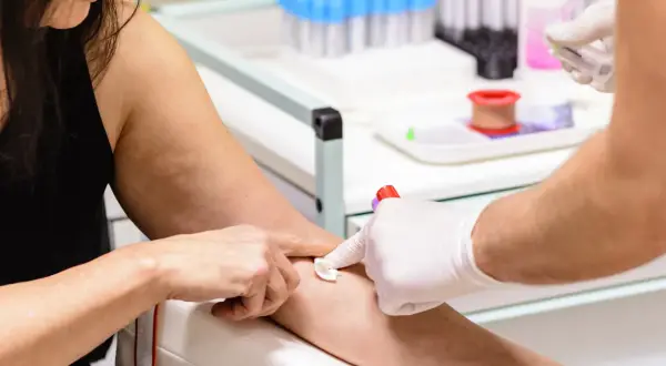 Pobieranie krwi do badań. Wyniki wskazują na mpv poniżej normy, co może wymagać dalszej diagnostyki.
