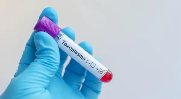 Rękawiczka w niebieskiej rękawiczce trzyma probówkę z oznaczeniem "Toxoplasma", z zaznaczonym wynikiem dodatnim. Badanie na toksoplazmozę objawy.