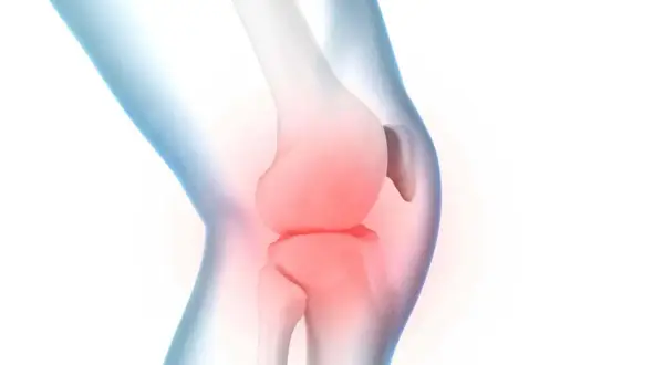 Illustration eines menschlichen Knies mit roter Hitze, die **Spannung im Knie** symbolisiert.